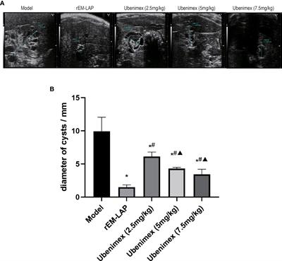 Therapeutic effect on Alveolar echinococcosis by targeting EM-Leucine aminopeptidase